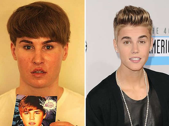 33-year-old fan spends $96,000 on surgery to look like Justin Bieber