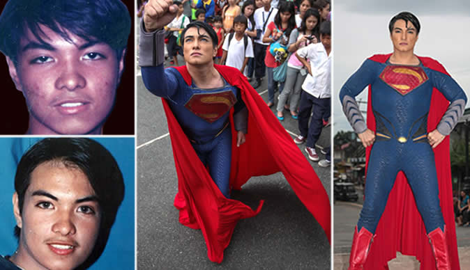 Man spends $6,800 on surgeries to make himself look like Superman