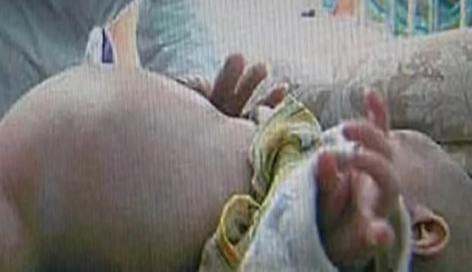 Pregnant 2-year-old boy gives birth