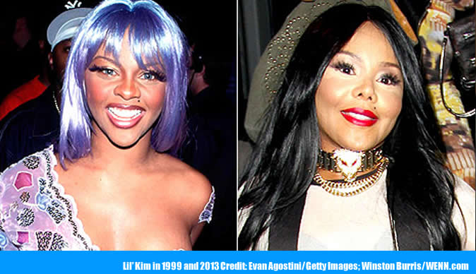 Lil' Kim's face looks dramatically different