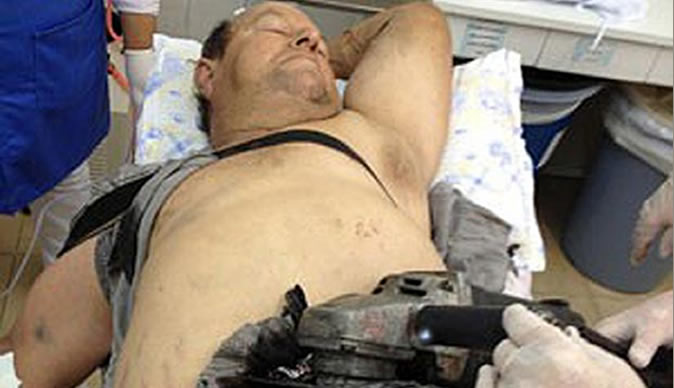 Farmer slices his stomach with saw
