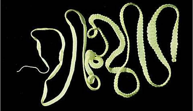 Woman eats tapeworm to lose weight